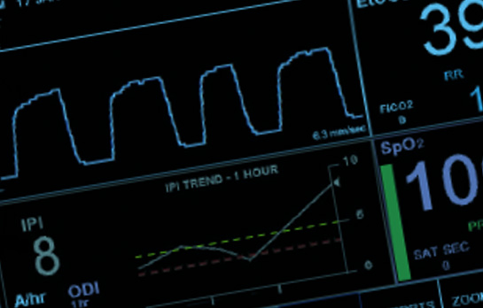 Quick Take: Surfing The Capnography Waveform - CapnoAcademy CapnoAcademy