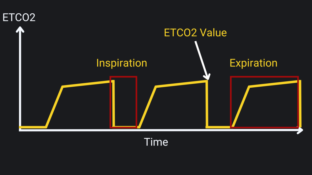 The critical role of capnography - CapnoAcademy CapnoAcademy